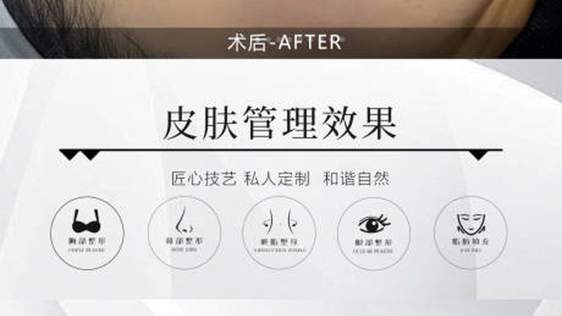 医美咨询师培训费用揭秘：影响成本的关键因素