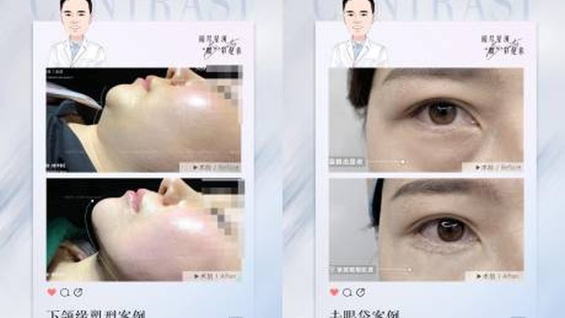 医用埋线提升线材，如何挑选吸收好的品牌？**