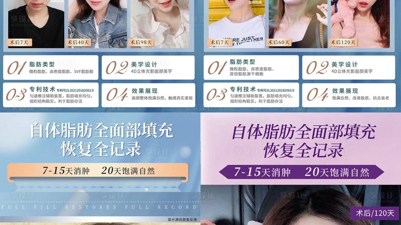 玻尿酸注射后，这些注意事项你了解吗？**
