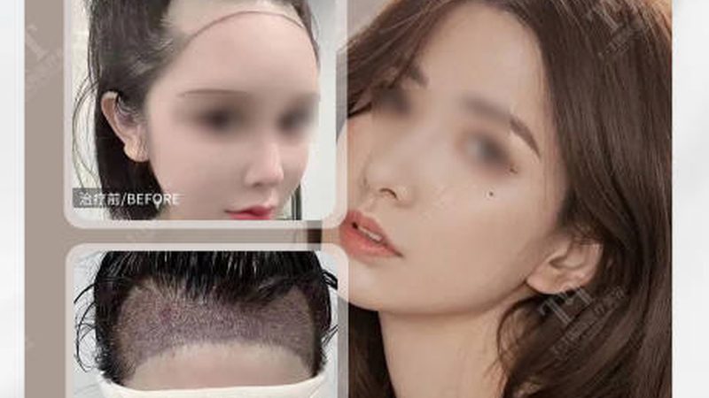 小标题：皮肤管理中心推荐的关键要素