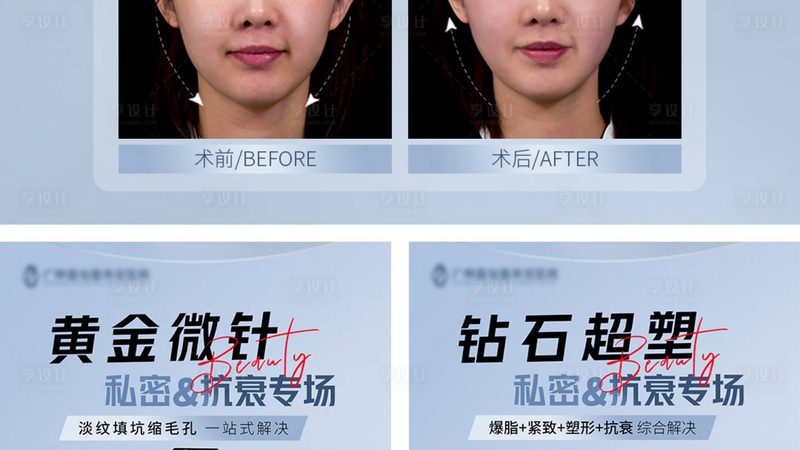 光子嫩肤祛痘印，真实用户分享她的蜕变之旅