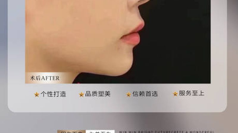 型号：XX型号