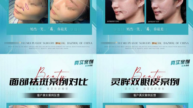 激光美容与光子嫩肤：流程解析与区别解读