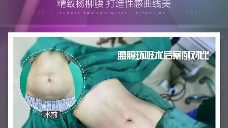男士瘦脸仪，如何挑选最适合自己的那一款？**