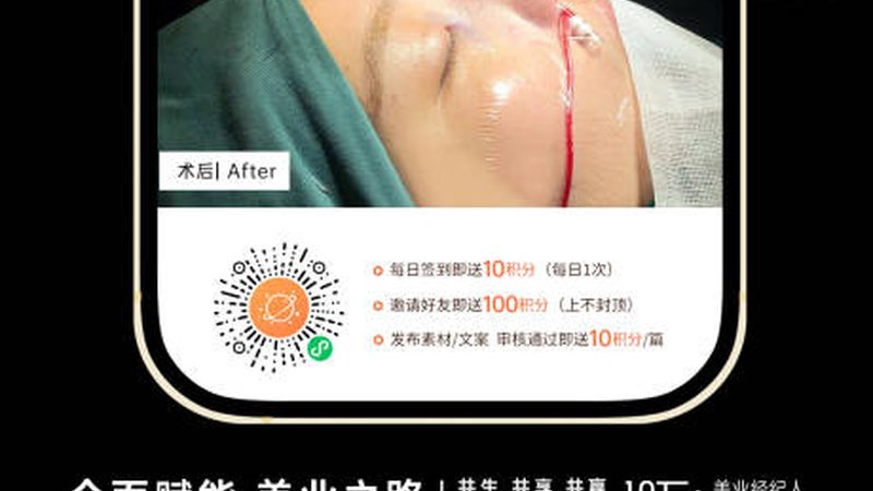肉毒素VS玻尿酸：揭秘两种美容注射的奥秘