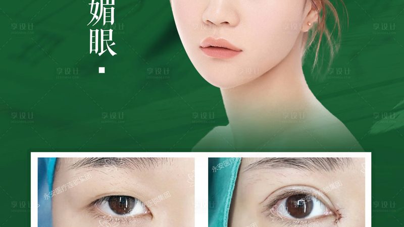 男士激光脱毛十大品牌排名