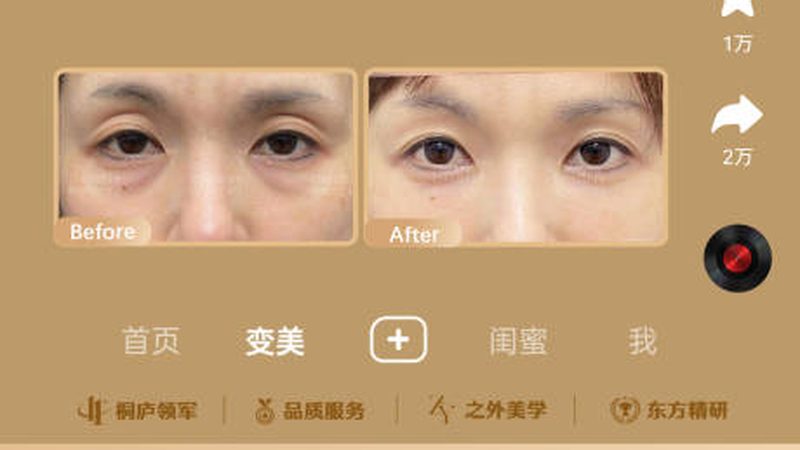 医美医生从业经验：揭秘背后的秘密