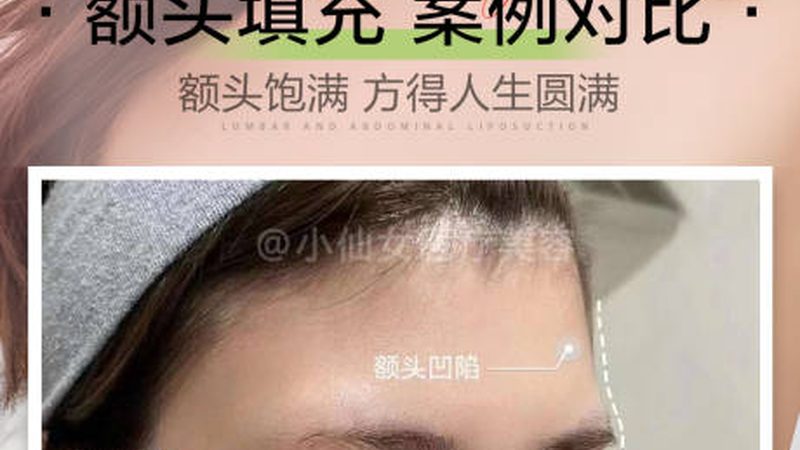 皮肤管理中心线上获客，揭秘五大高效策略